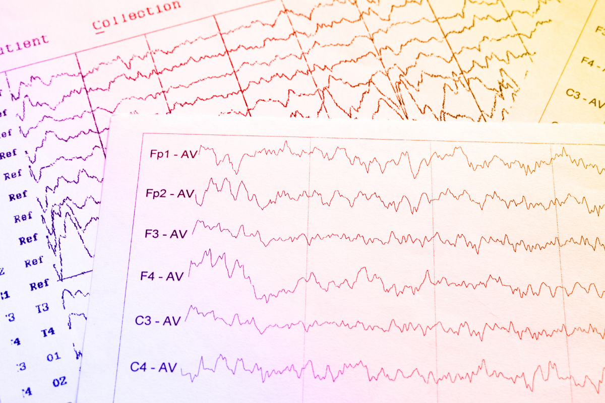 Neural Scan EEG Results