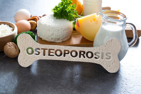 Nutrient-rich foods that prevent osteoporosis and improve bone health for women