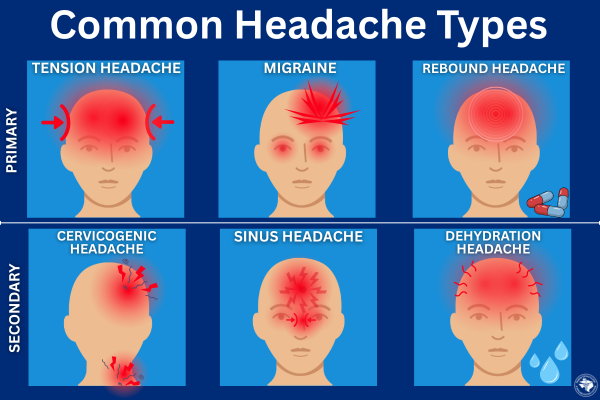 Common Headache Types and their symptoms