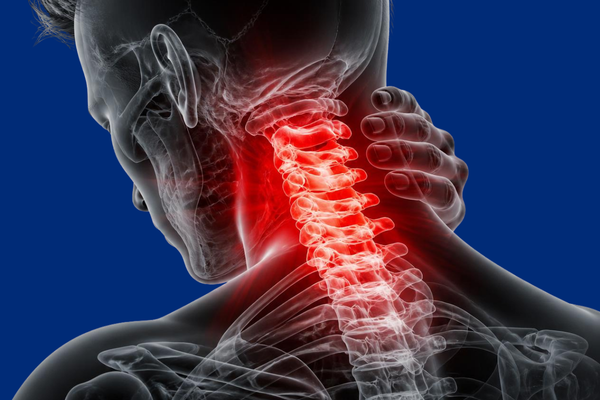 X-ray-like image of a man suffering from neck pain